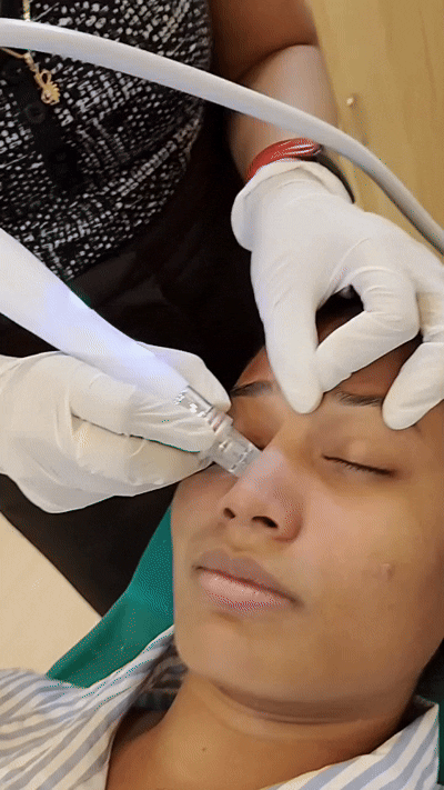Hydrafacial